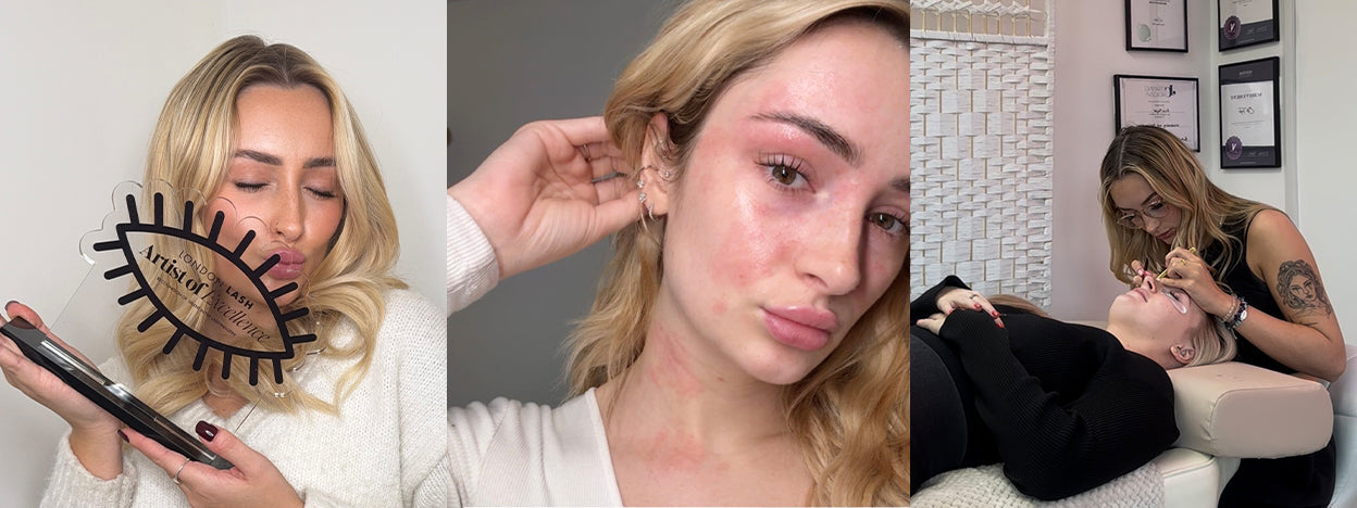 Plot Twist: I Became Allergic to My Own Industry
